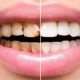 previous thumbnail